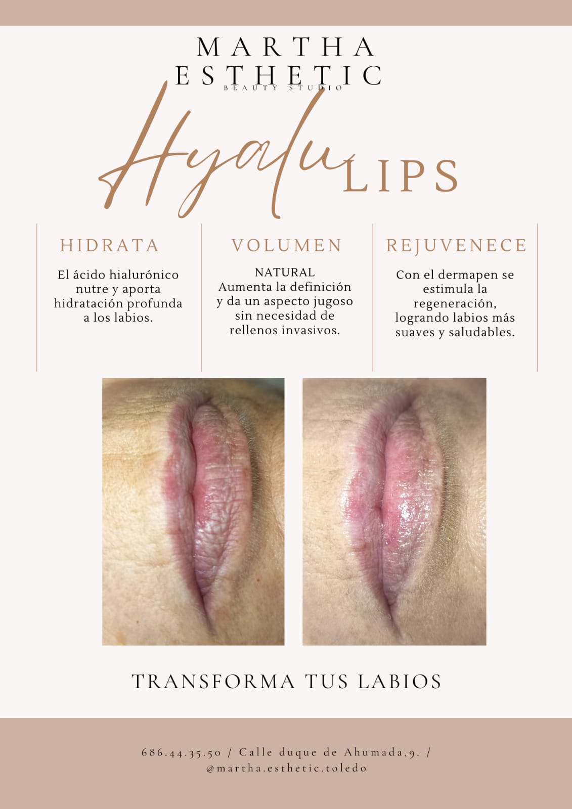 Hyalulips