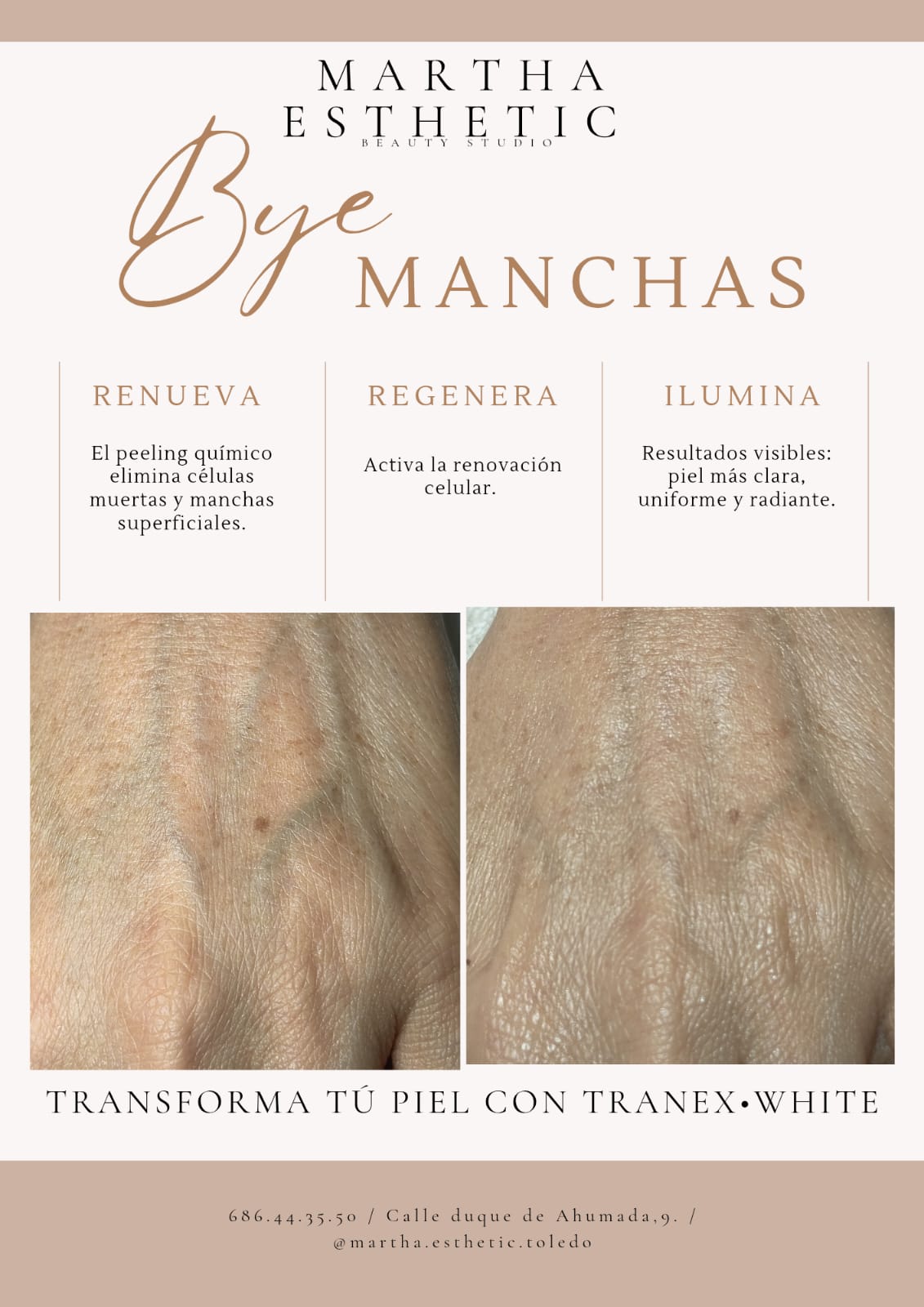 poster tratamiento tranex